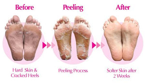 Pediluxe Foot Exfoliating Peel - 2 Pack